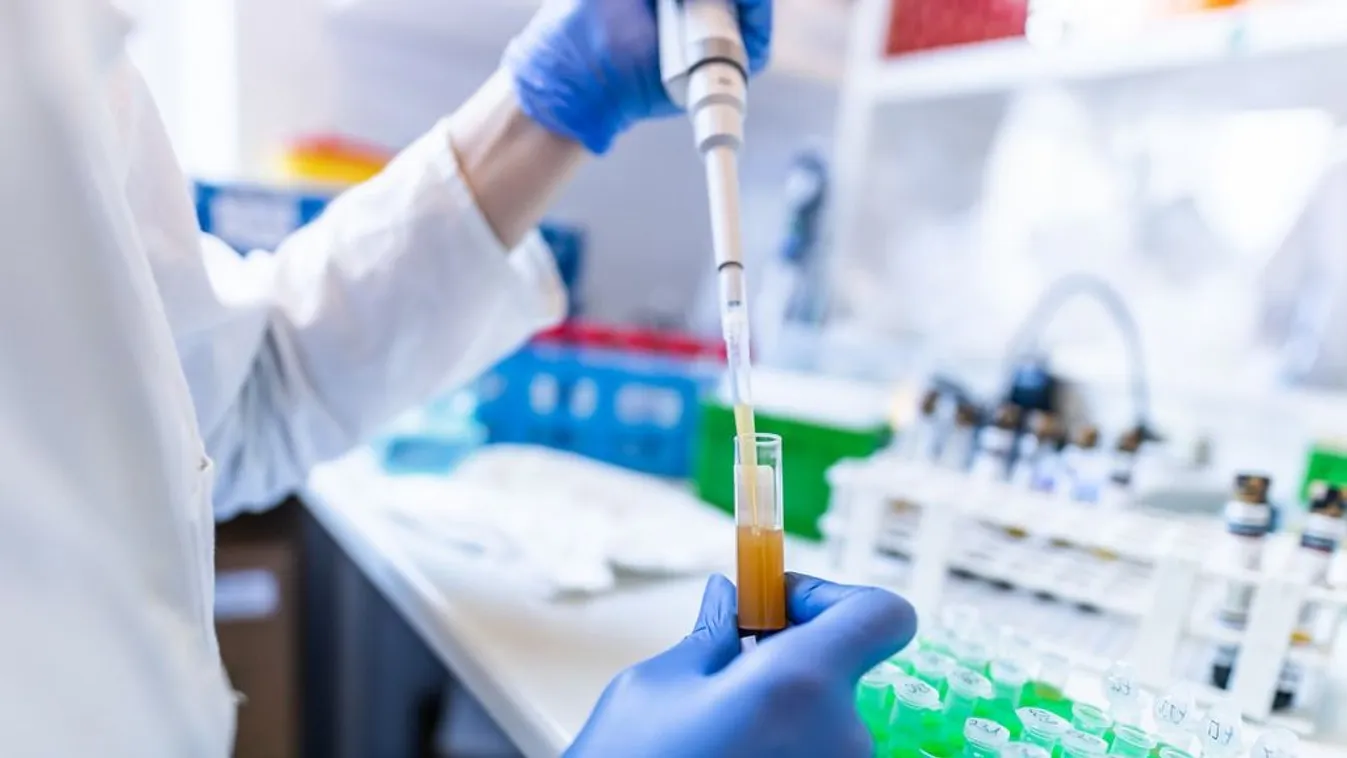 Magyar siker: vérből is kimutatják, kilökődhet-e az új szív