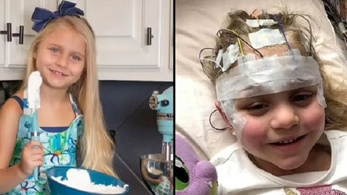 Demenciát diagnosztizáltak egy 7 éves kislánynál