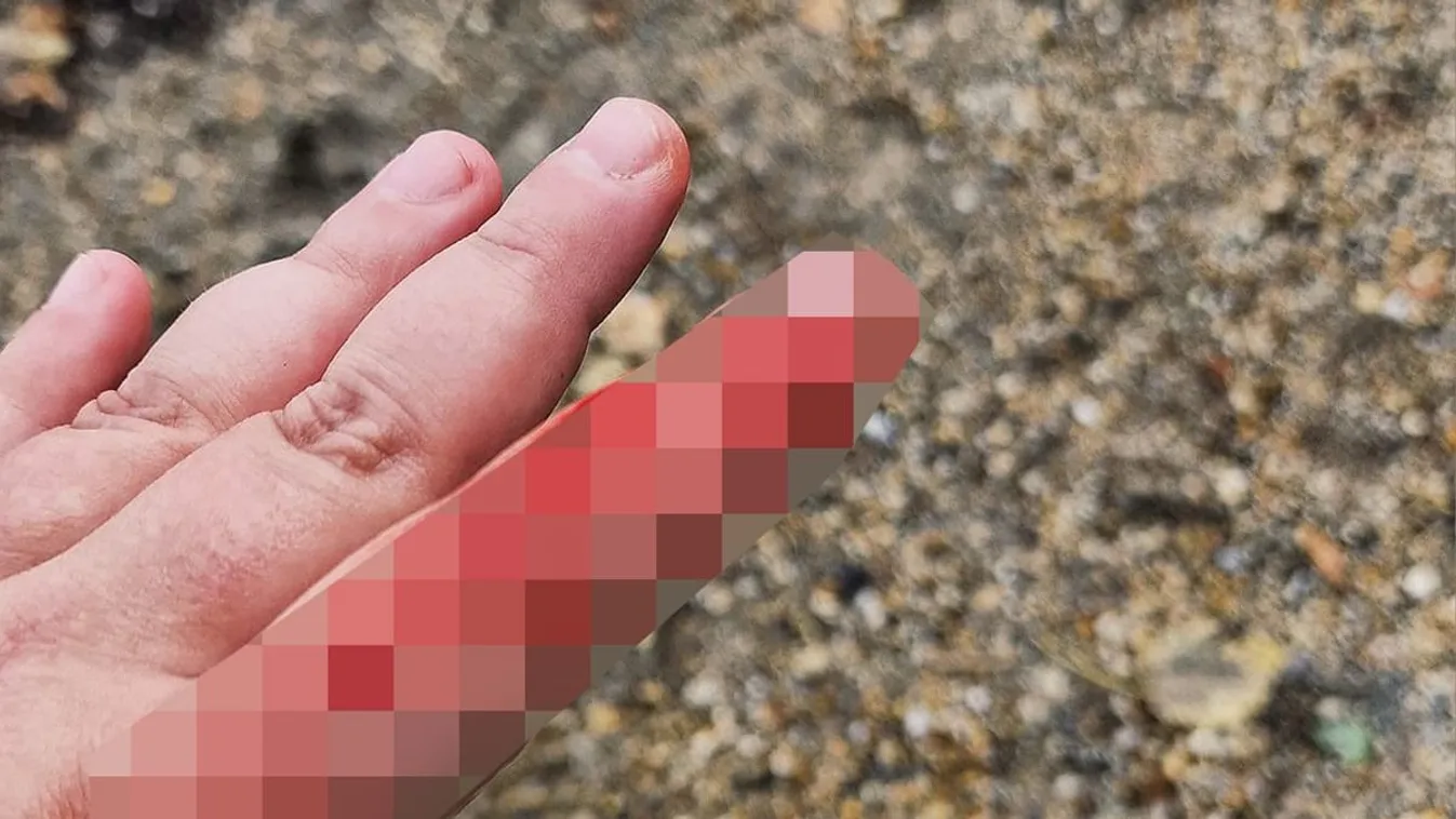 Póráz nélküli kutya harapott meg egy idős nénit Dunakeszin