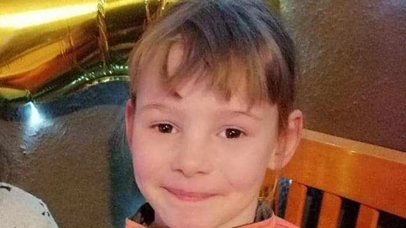 Édesanyjáért aggódik a súlyosan megégett kislány