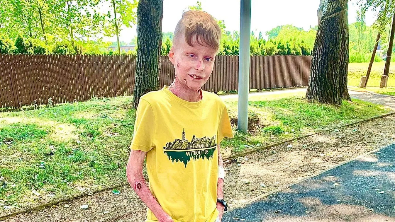 Olvasóinkat is megrendítette a gyógyíthatatlan tini sorsa