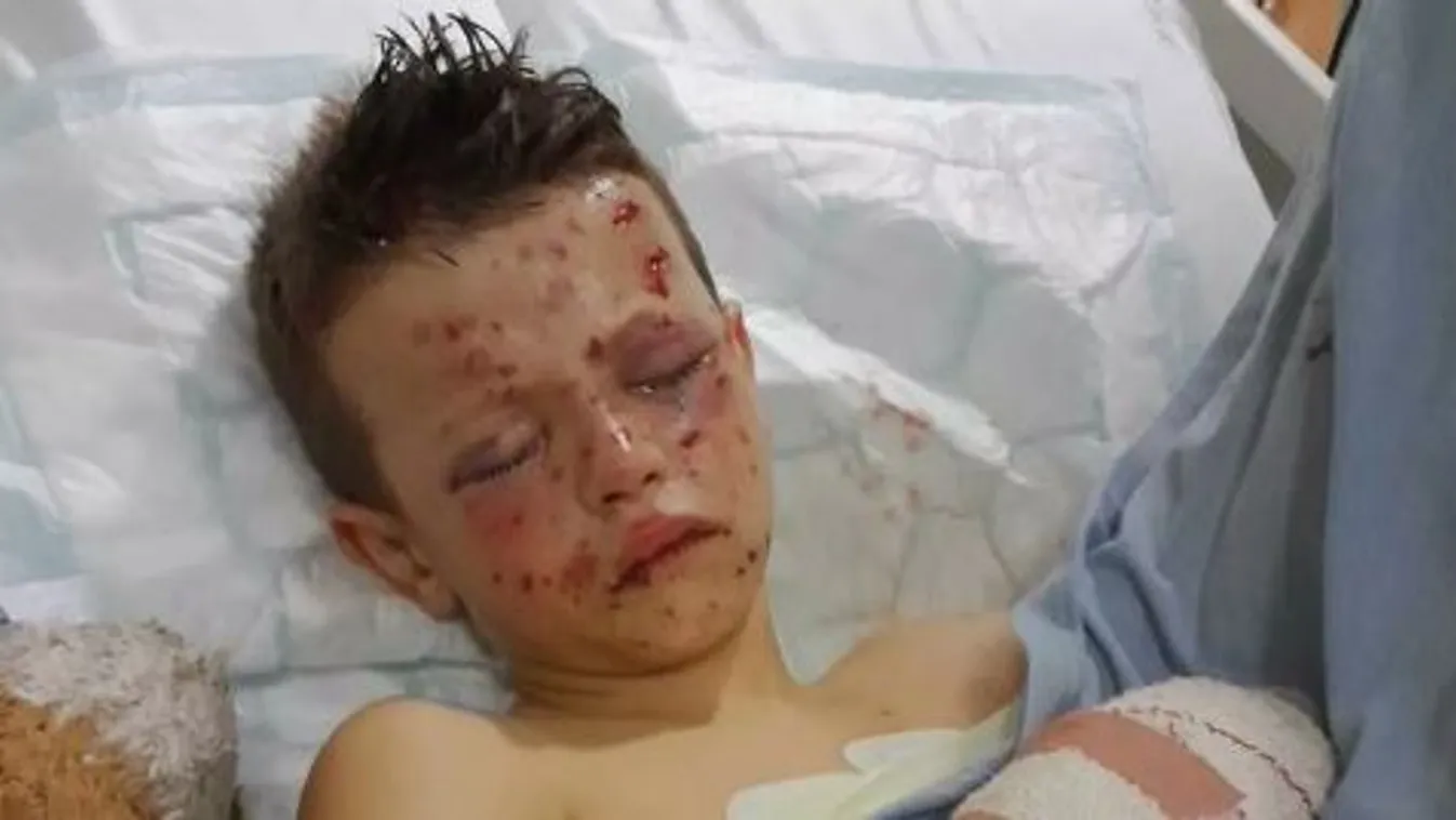 Vandál kamaszok petárdával dobáltak meg egy 9 éves kisfiút