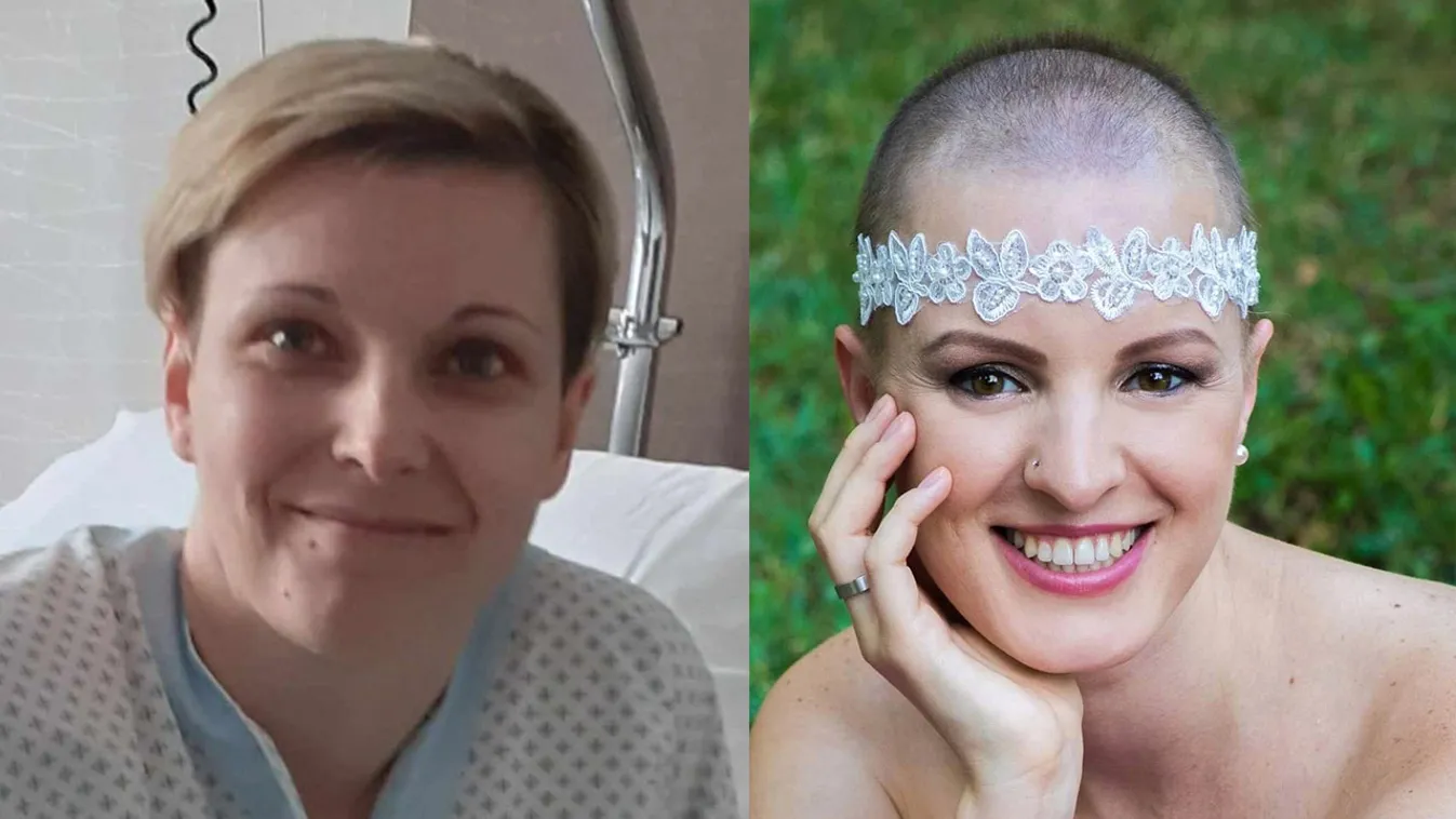 Édesanyák, akik legyőzték a mellrákot