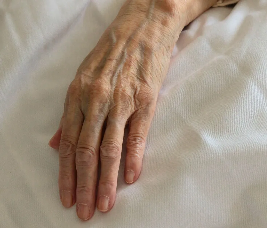 kéz, öregség, öregedés