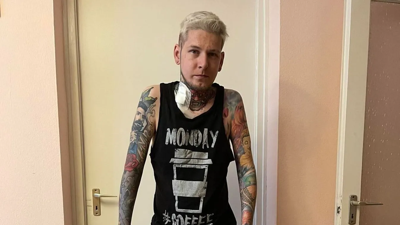 Meglepetés érte Zolit, miután amputálni kellett a lábát