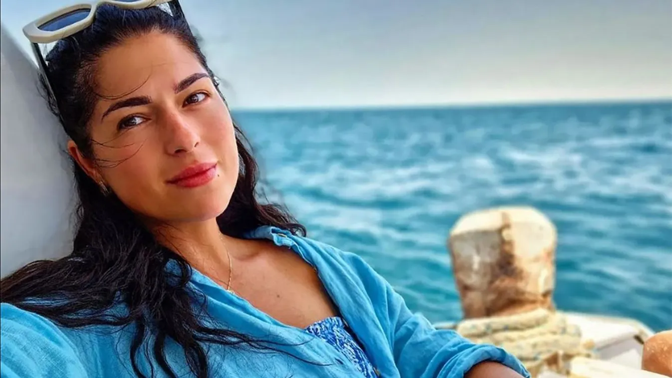 Szinte rá sem ismerni Horváth Grétára a plasztika után