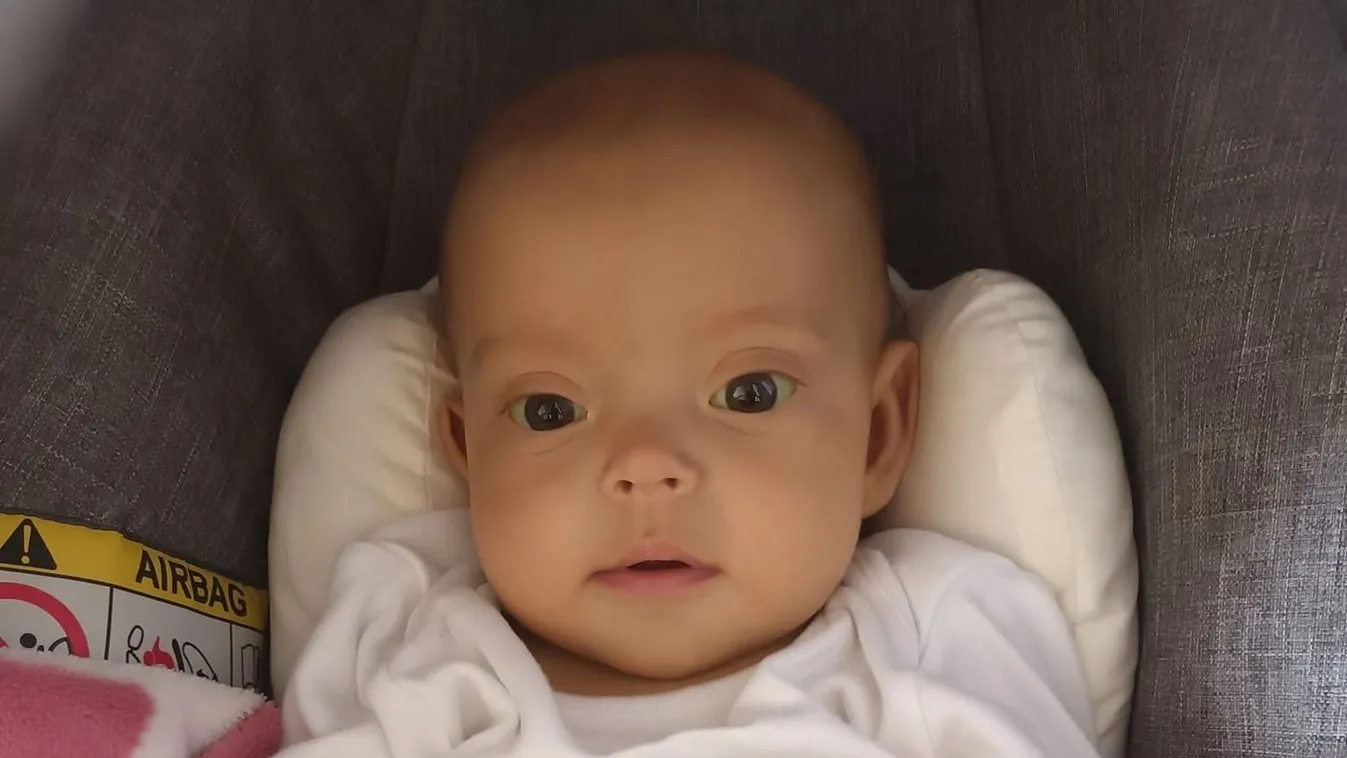 Édesapja lett a májdonorja a 8 hónapos súlyos beteg Lénának