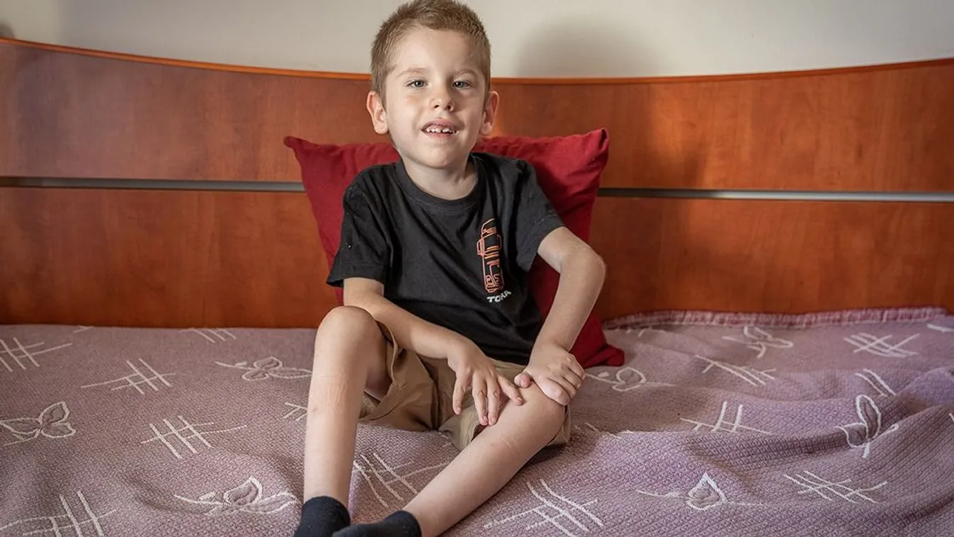 Dubaiban kaphatja meg a kezelést SMA Tomika