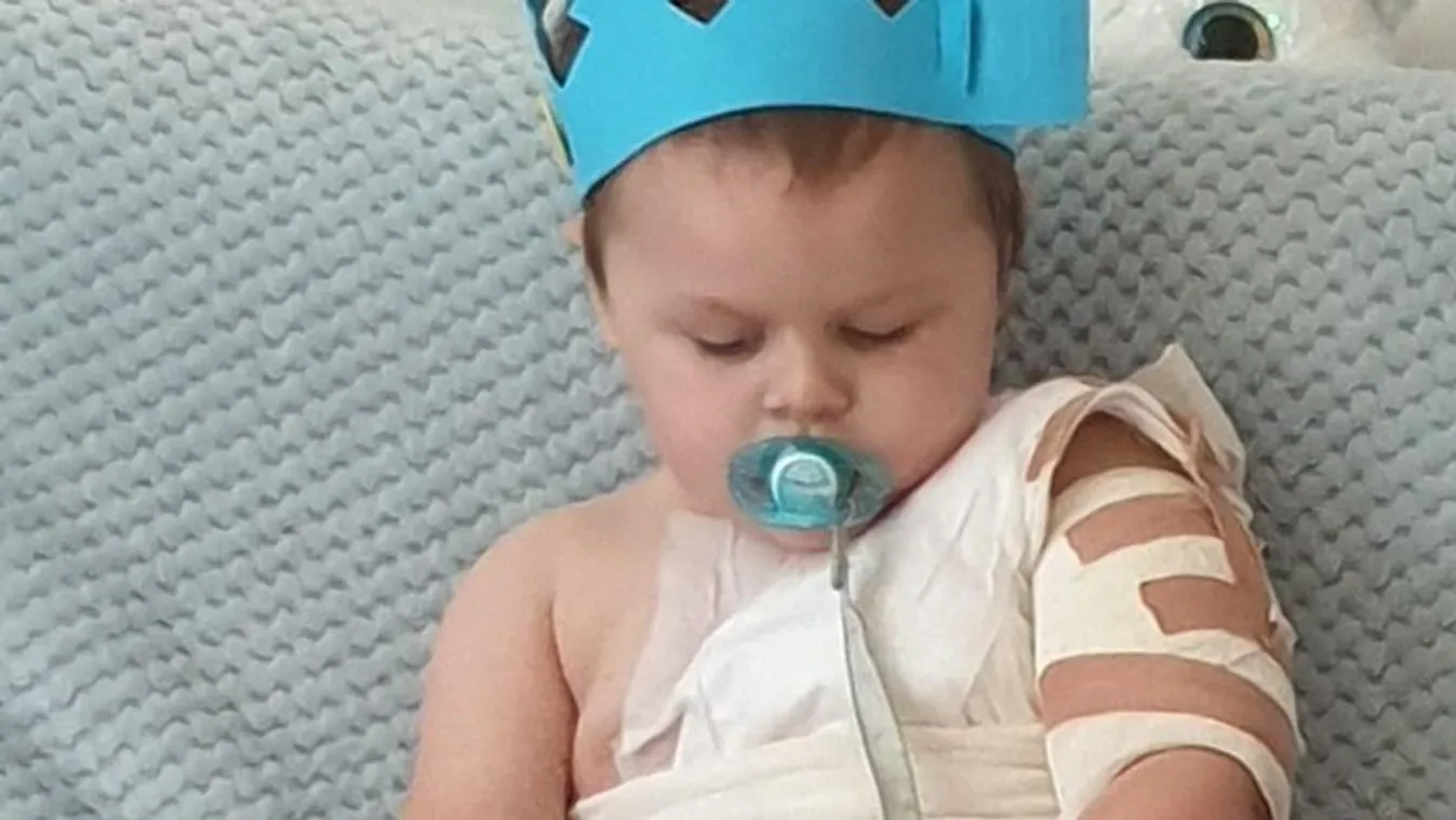 Szörnyű kínokat élt át a kávéval leforrázott kétéves