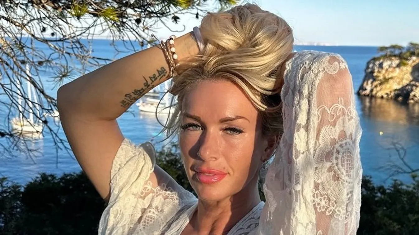 Felismerhetetlen a plasztikázástól Molnár Anikó