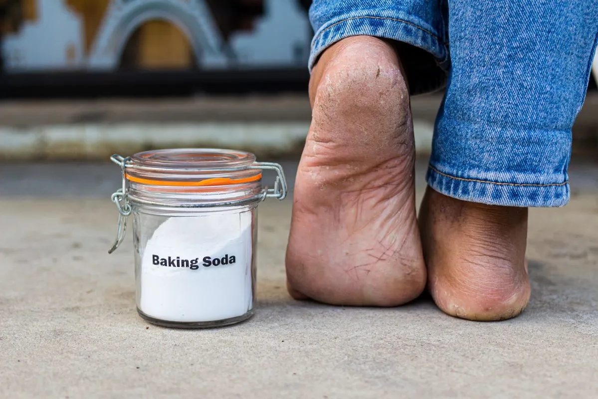 Bottle,Of,Baking,Soda,Near,The,Heel,Cracked,Health,And