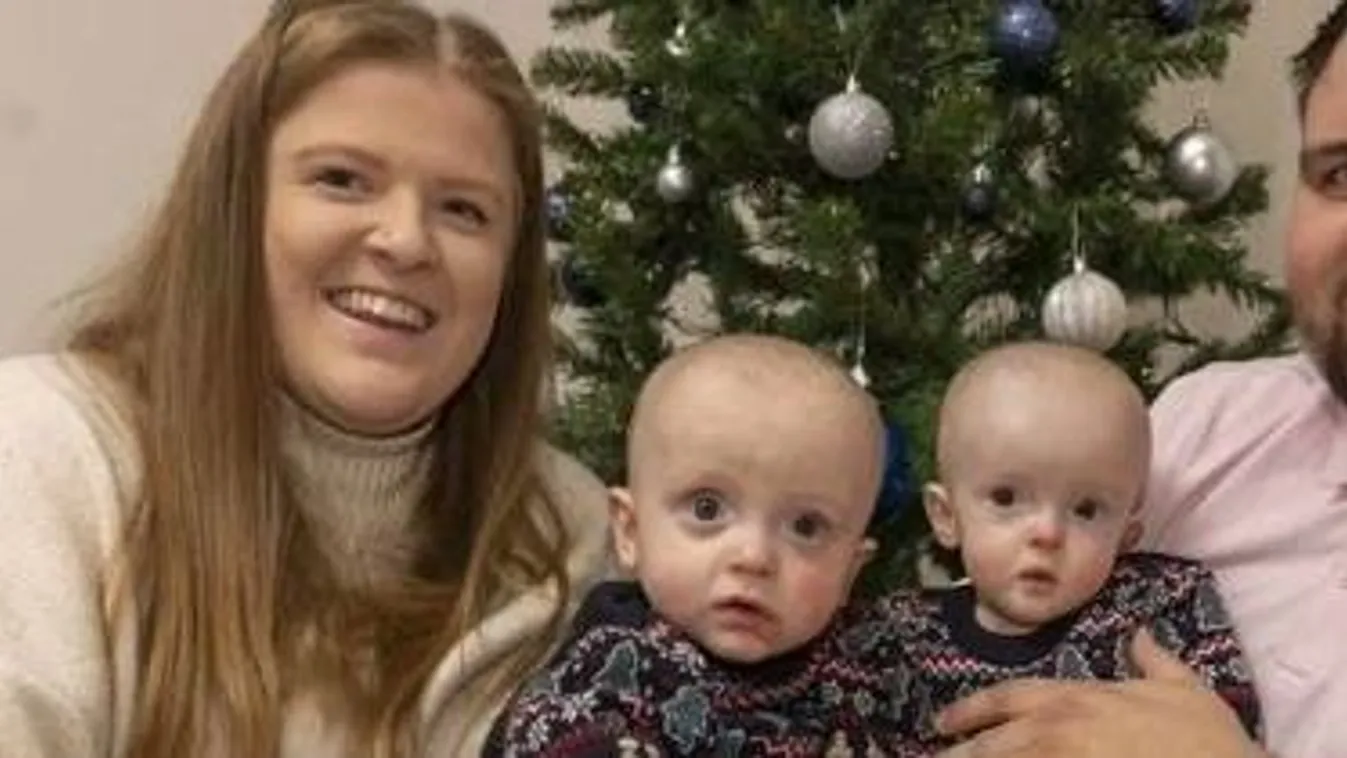 Első karácsonyát ünnepli a 27 hetesen született kisfiú