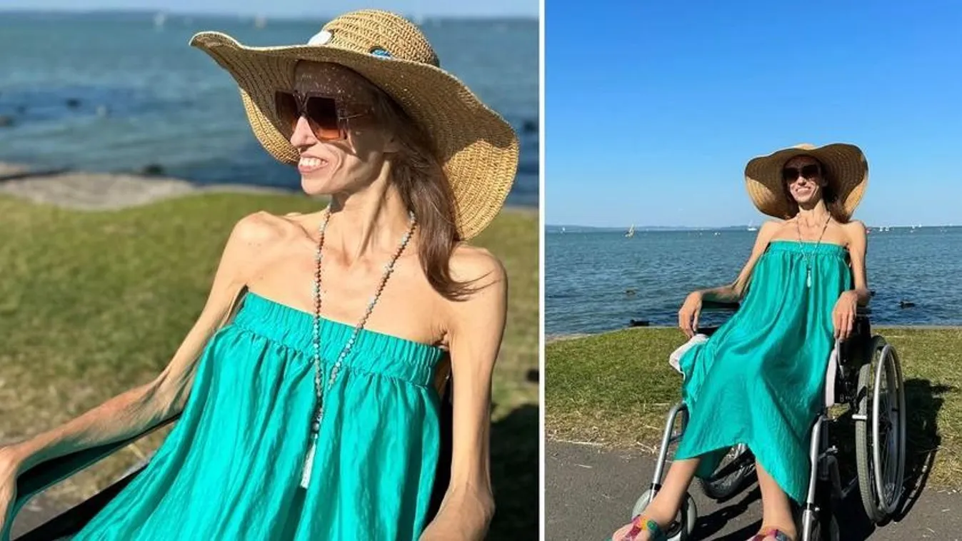 Másodszor támadta meg a rák a fiatal lány szervezetét