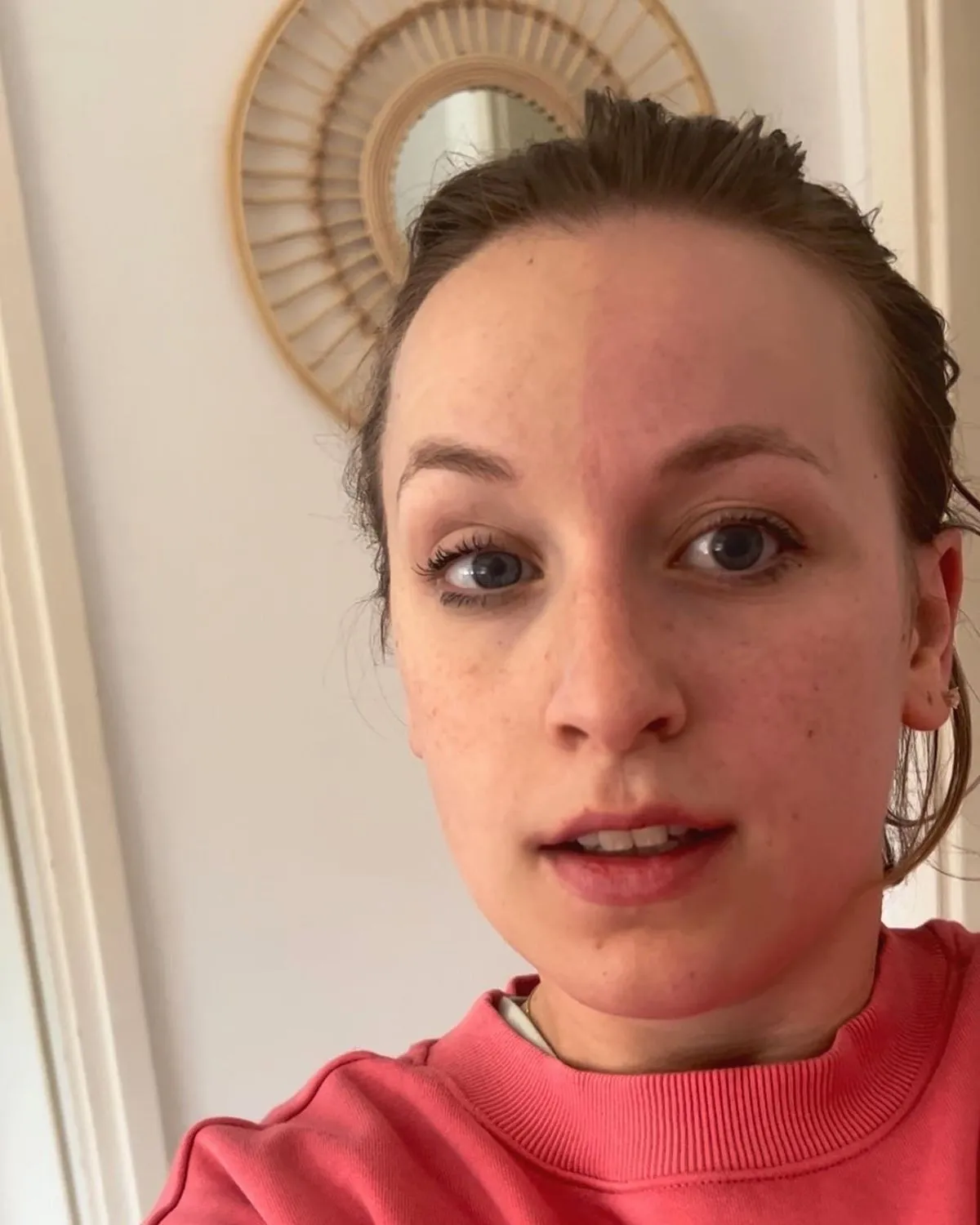 Fanni rák betegség