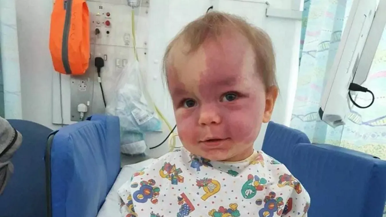 Megtette első lépéseit a ritka betegséggel küzdő Lily