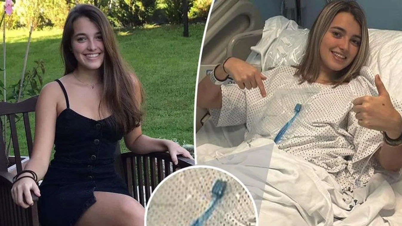 Lenyelte a fogkeféjét egy fiatal nő egy véletlen balesetben