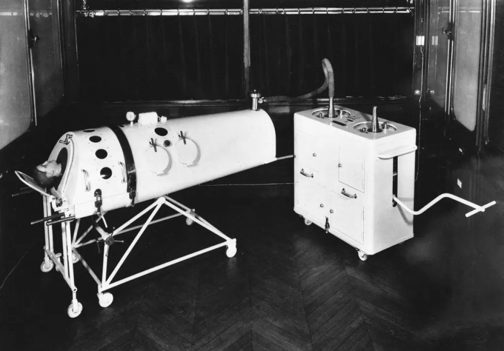 Iron lungs, Binet-Bochet pattern and