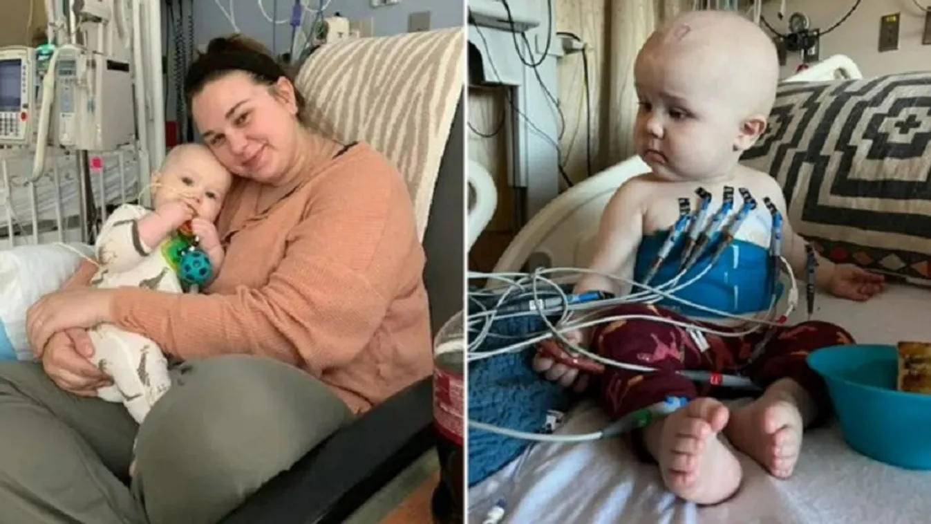 Fogzásnak hitték a 8 hónapos baba rákos tüneteit