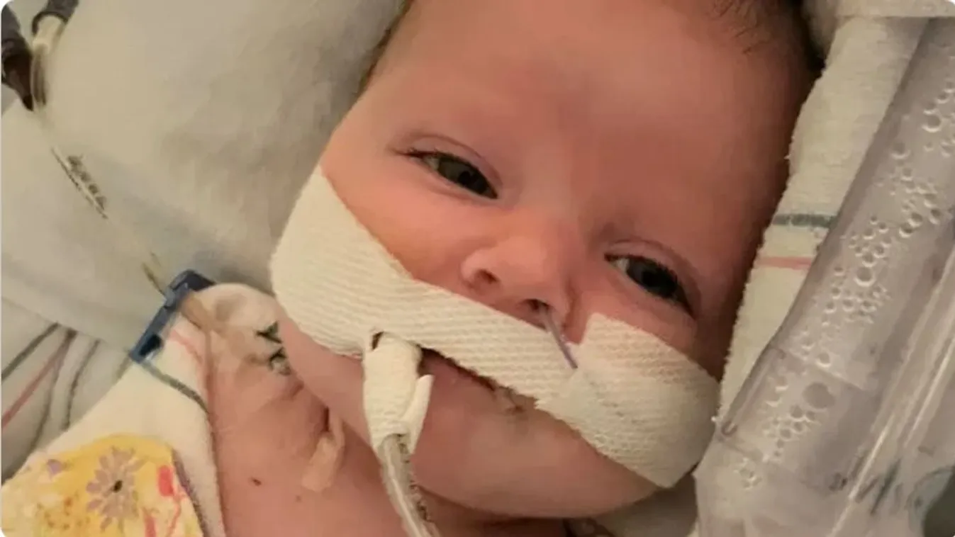 A szervátültetés mentheti meg egy 2 hónapos kisbaba életét