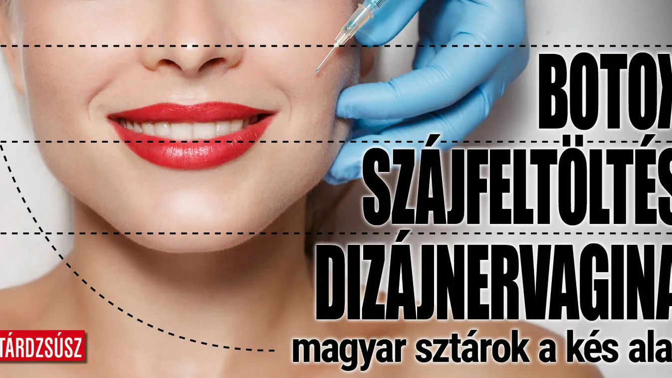 Ezek a magyar hírességek többször is kés alá feküdtek