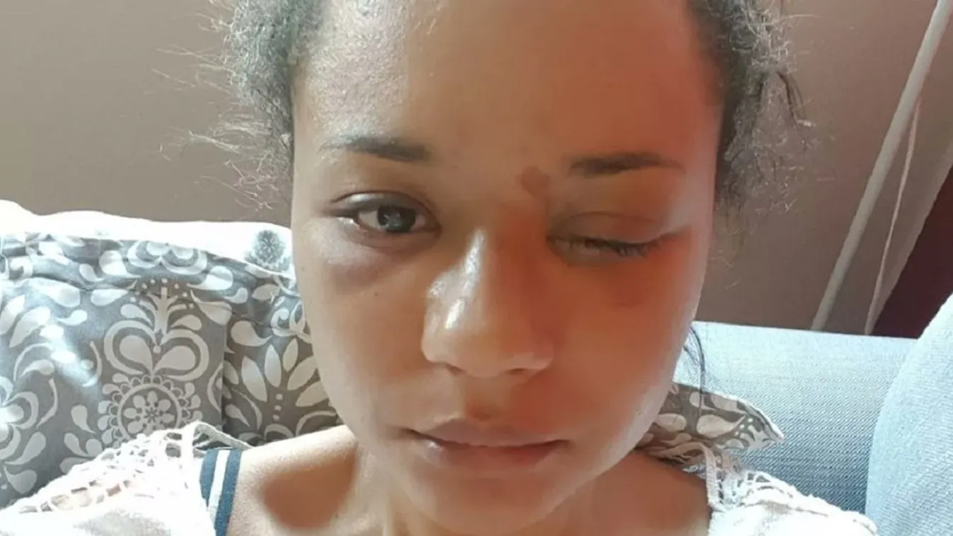 Szörnyű árat fizetett Jennifer, amiért túlélte a balesetét