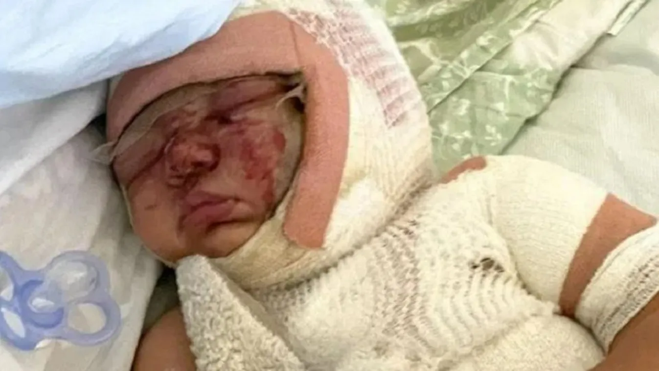 Kiborult a kávé: egy hajszálon múlott az egyéves élete