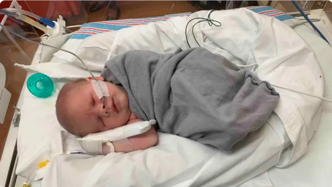 Csukott szemmel született egy baba