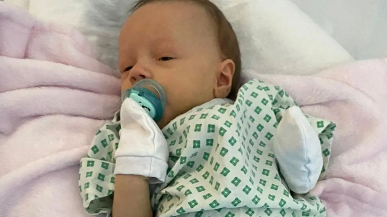 Meglepő jel utalt a tündéri baba betegségére