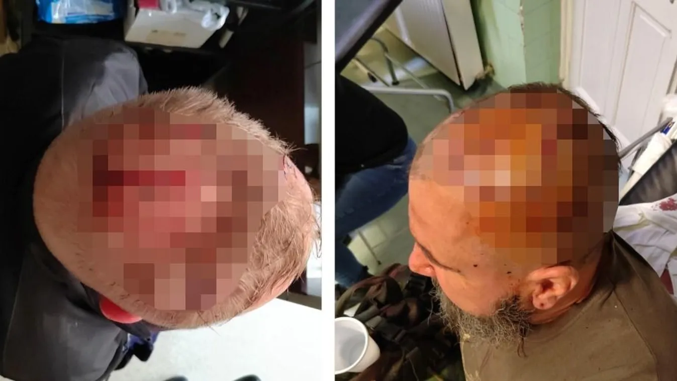 Aljas módon, hátulról támadtak áldozataikra az antifák