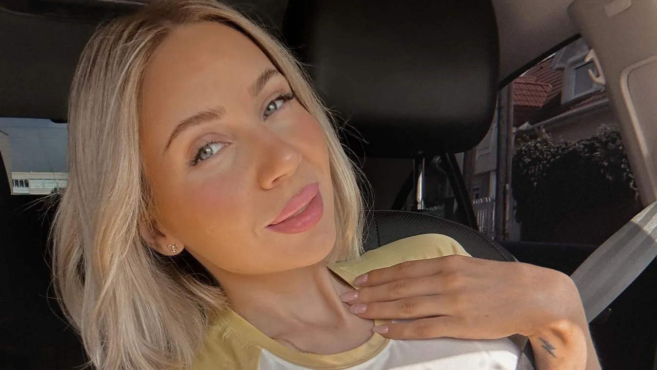 Duplájára dagadt a magyar énekesnő arca - Fotó