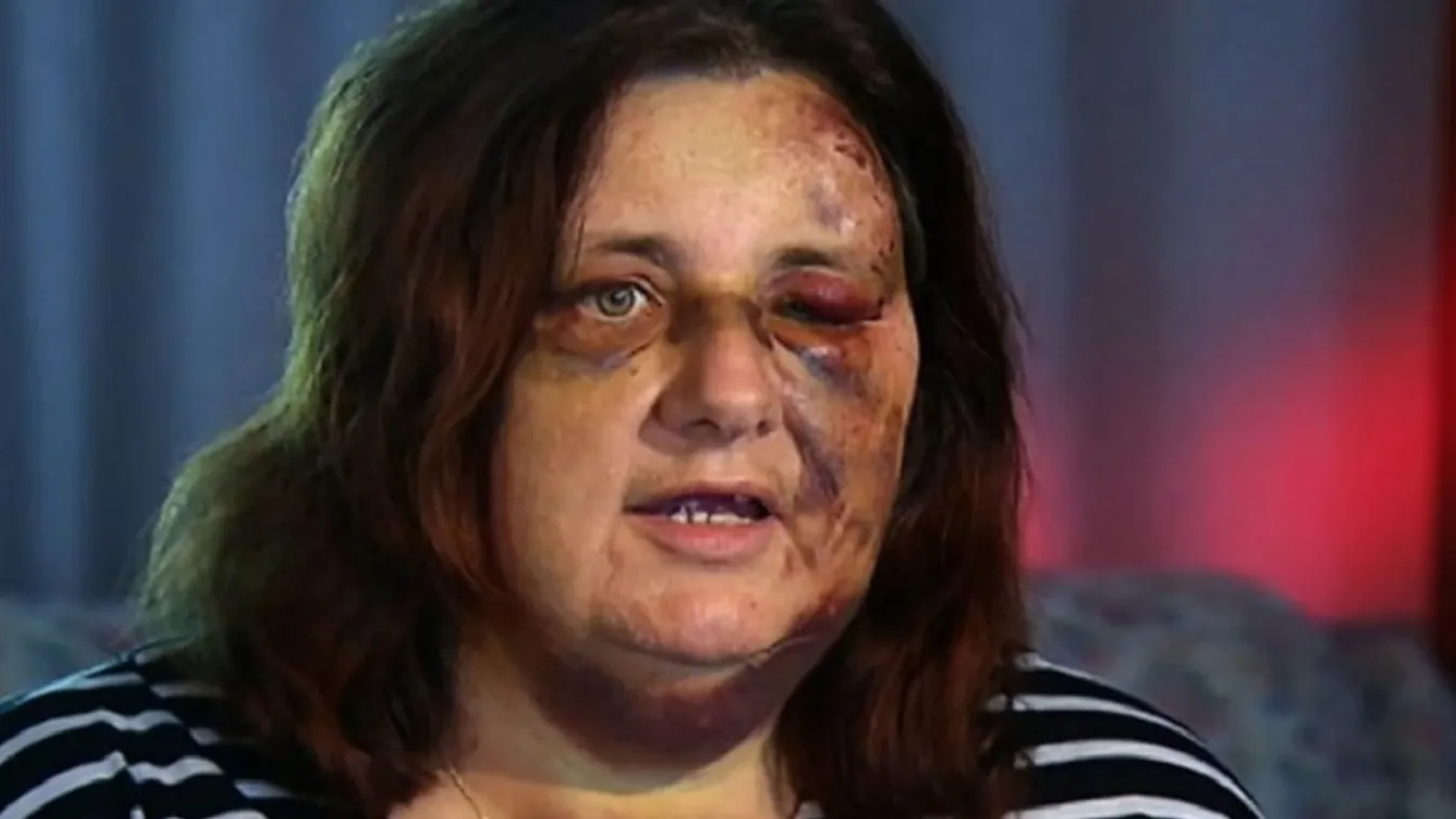 Fél órát sem adtak az orvosok a halál küszöbén álló anyának