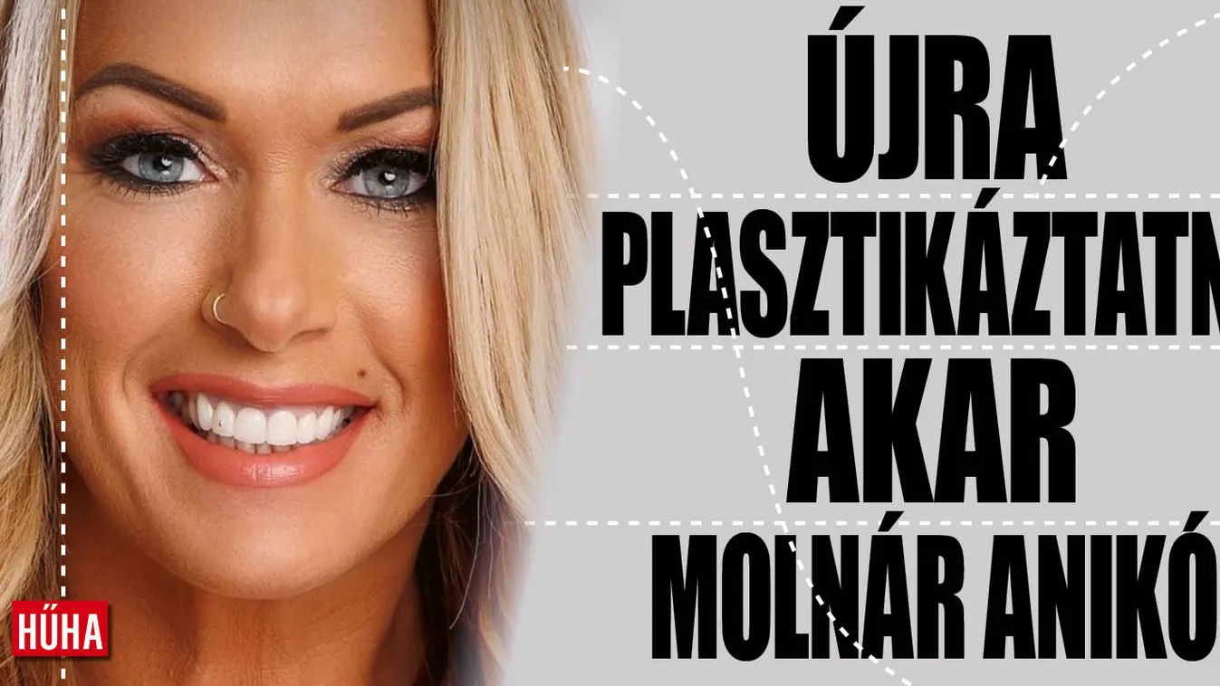 Kés alá fekszik Molnár Anikó