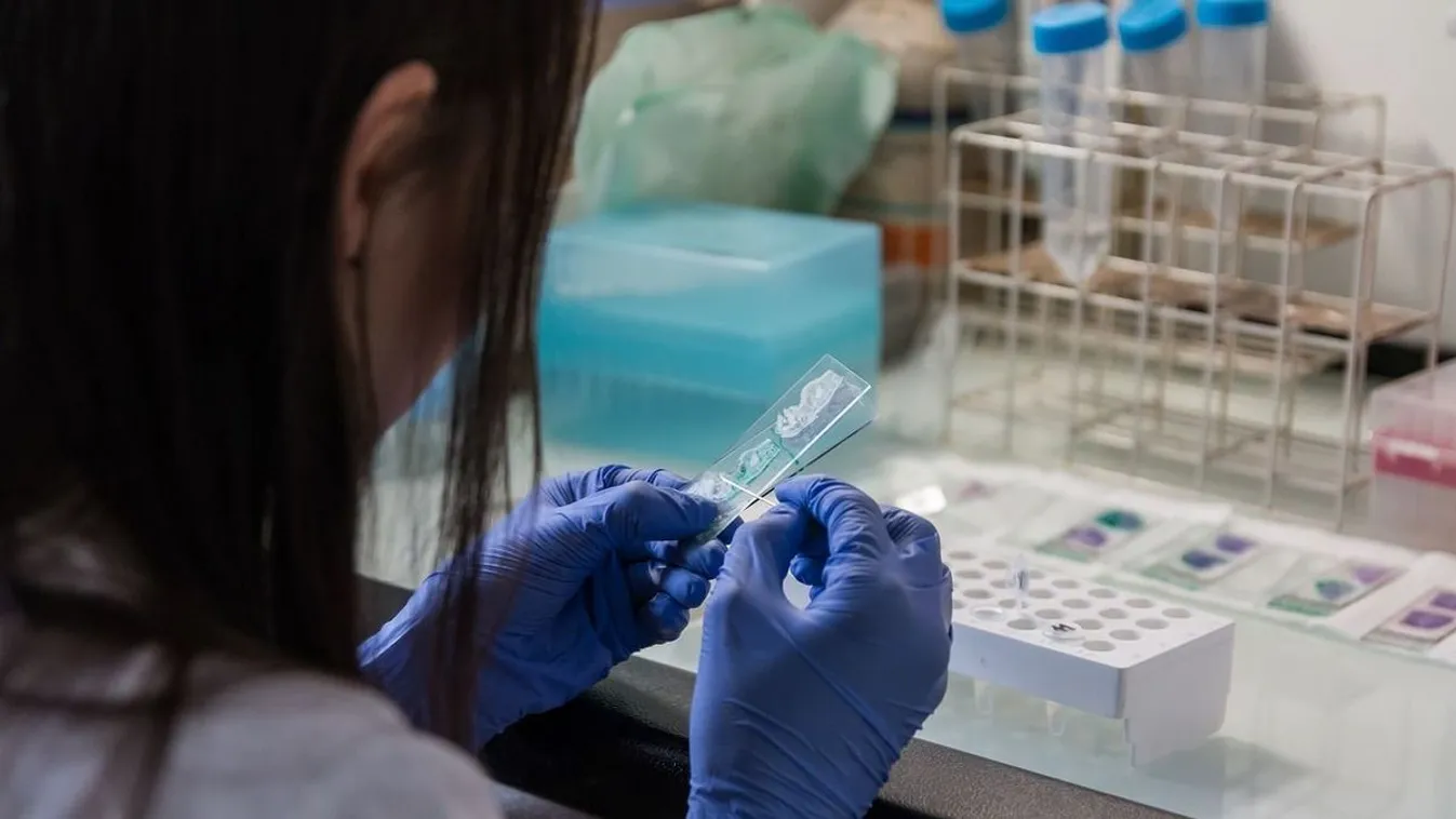 Vértesztet fejlesztettek az Alzheimer-kór kimutatására