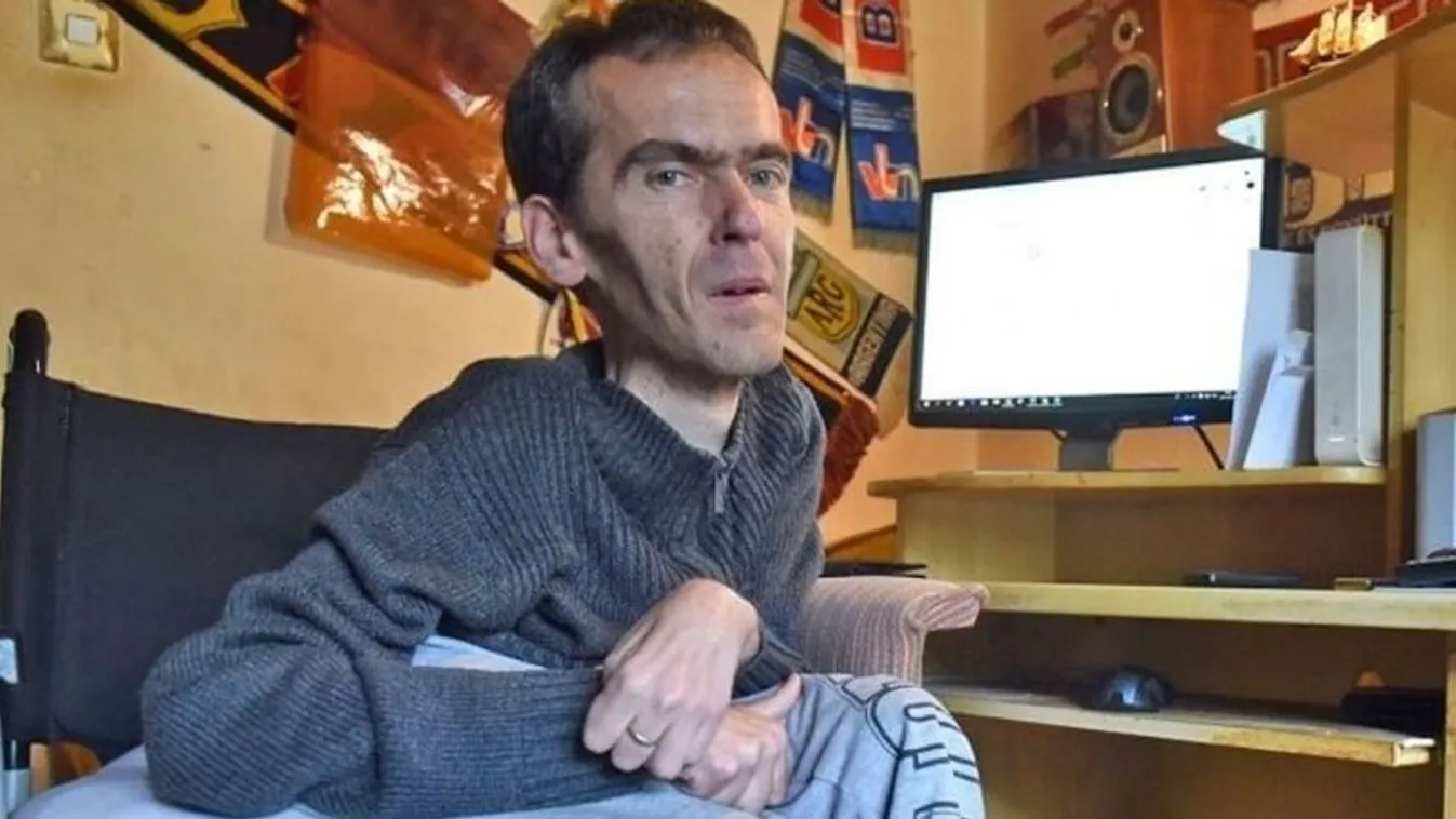 Több millió forintos fogászati kezelésre szorul SMA Sankó