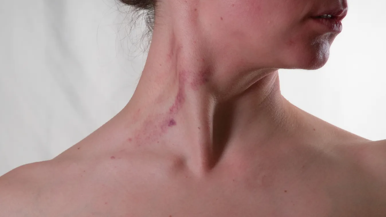 Duplájára nőtt a csoportos nemi erőszak áldozatainak száma