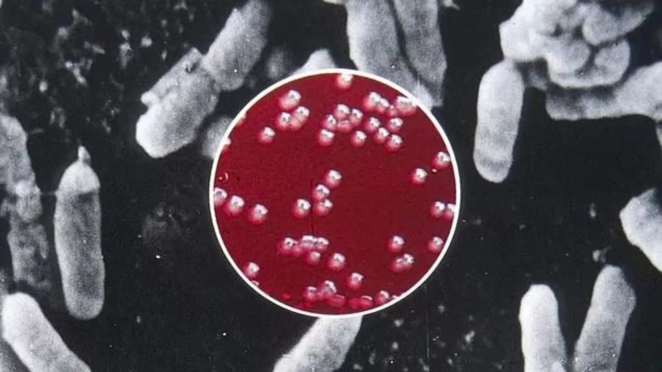 Bubópestisben halt meg egy ember Amerikában