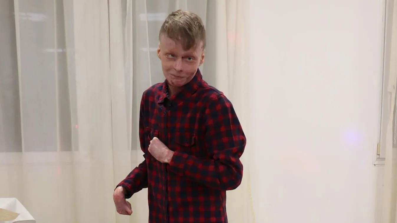 A bőrbeteg Flórián rosszindulatú üzeneteket kap