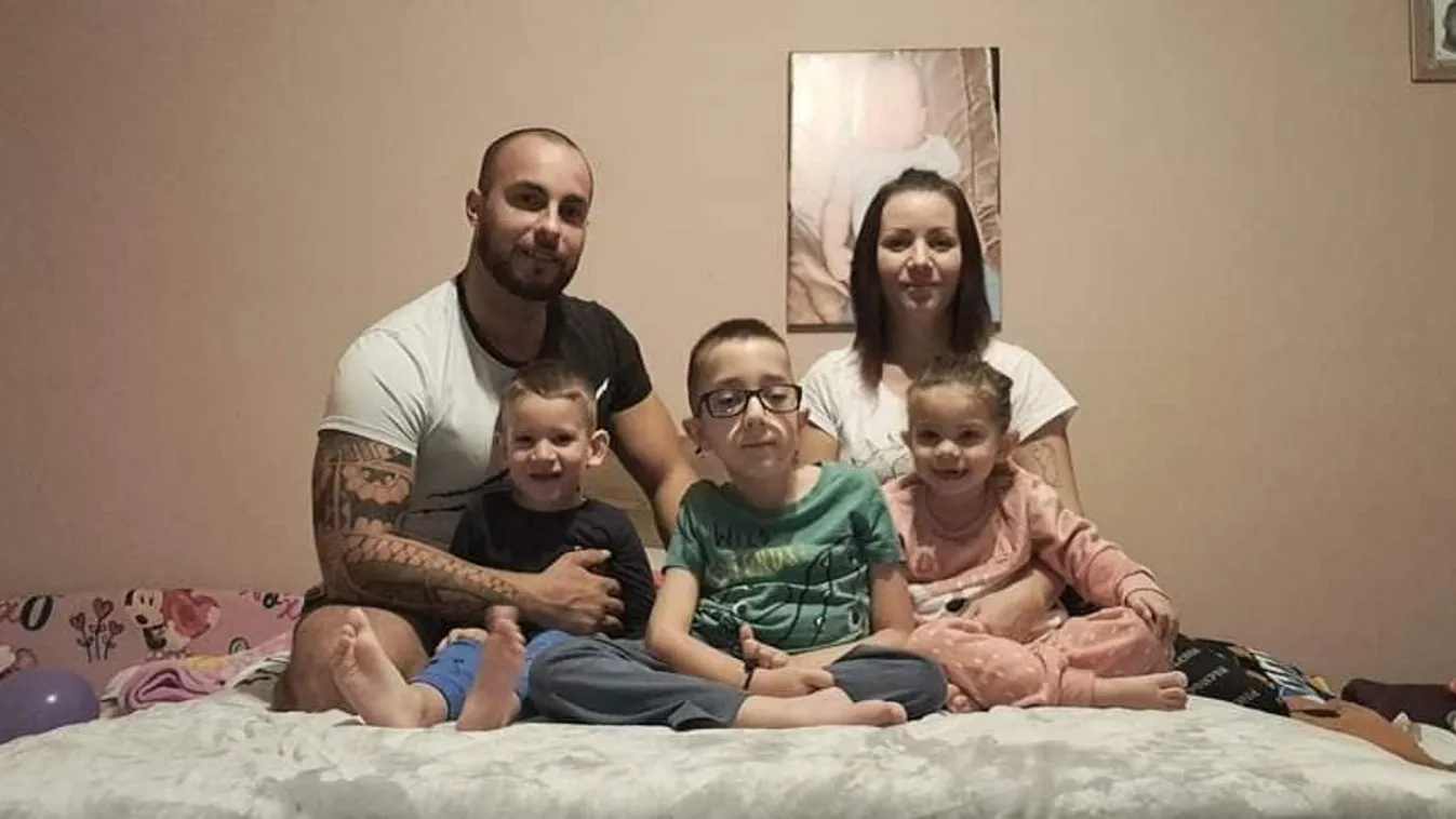 Kihullott a 3 éves Majácska haja - ezzel a betegséggel küzd