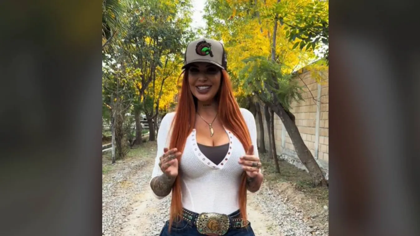 Zsírleszívó műtét végzett az Instagram-sztárral