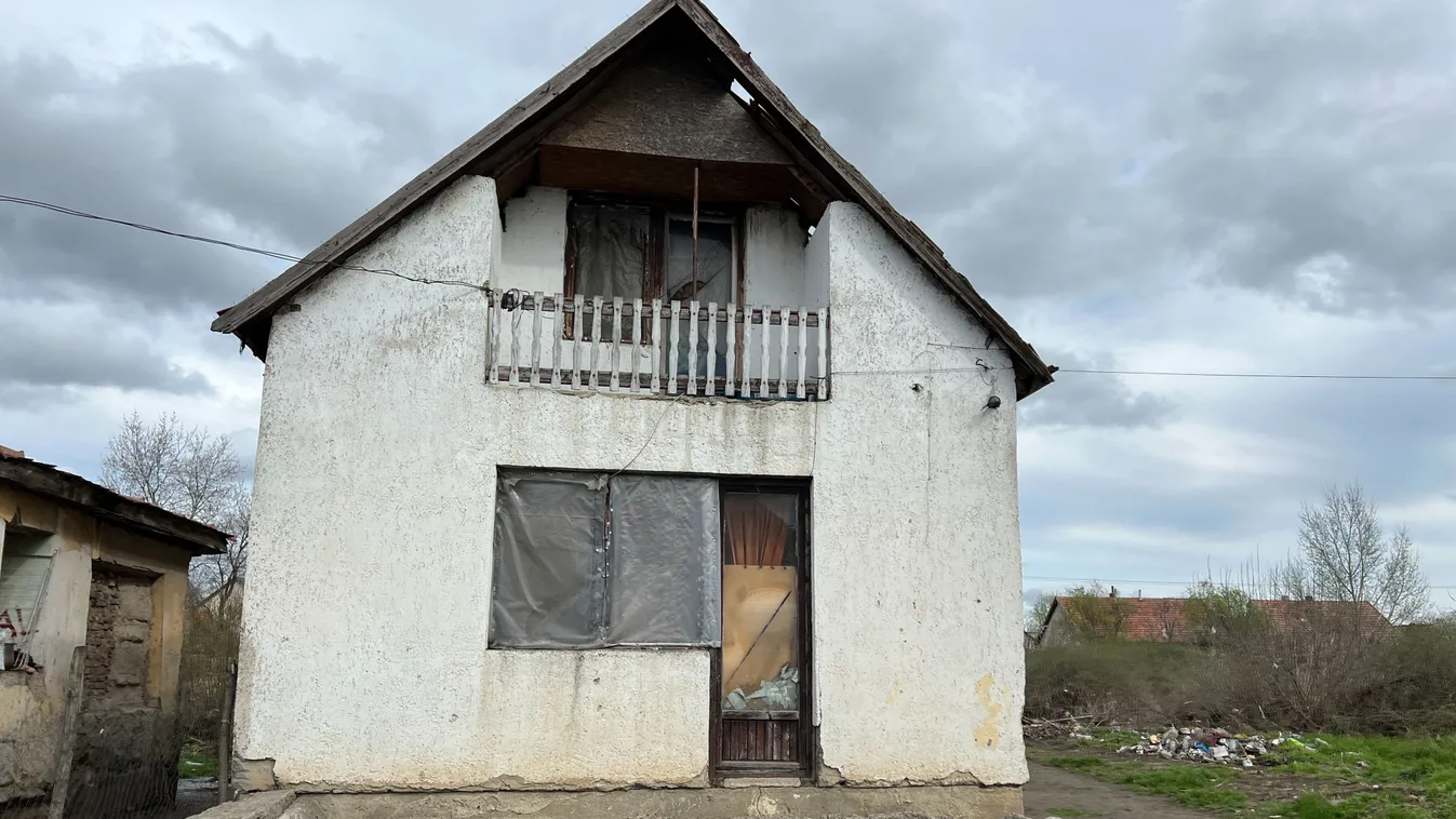 Új hírek érkeztek a 4 éves megégett Ajsáról