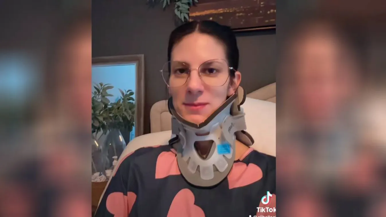 A fejét sem bírja megtartani: lebénult a botoxtól egy anya