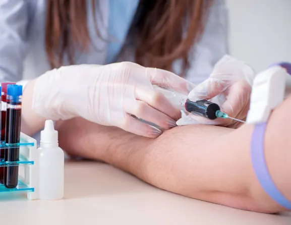 Hatalmas áttörés az Alzheimer-szűrésben: új vérvizsgálattal tünetmentes szakaszban felismerik a betegséget, Véradás applikáció