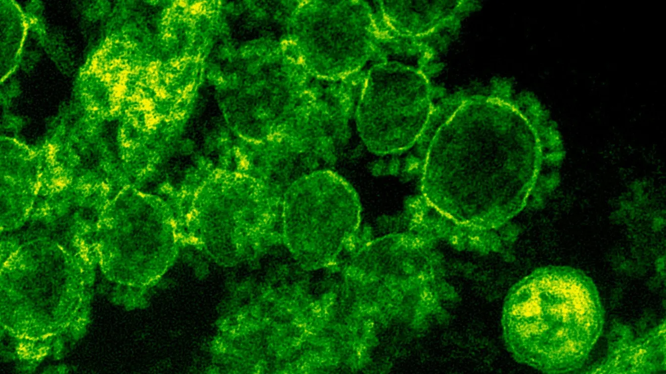 Könnyebb elkapni a leghalálosabb fertőzést, mint gondolták