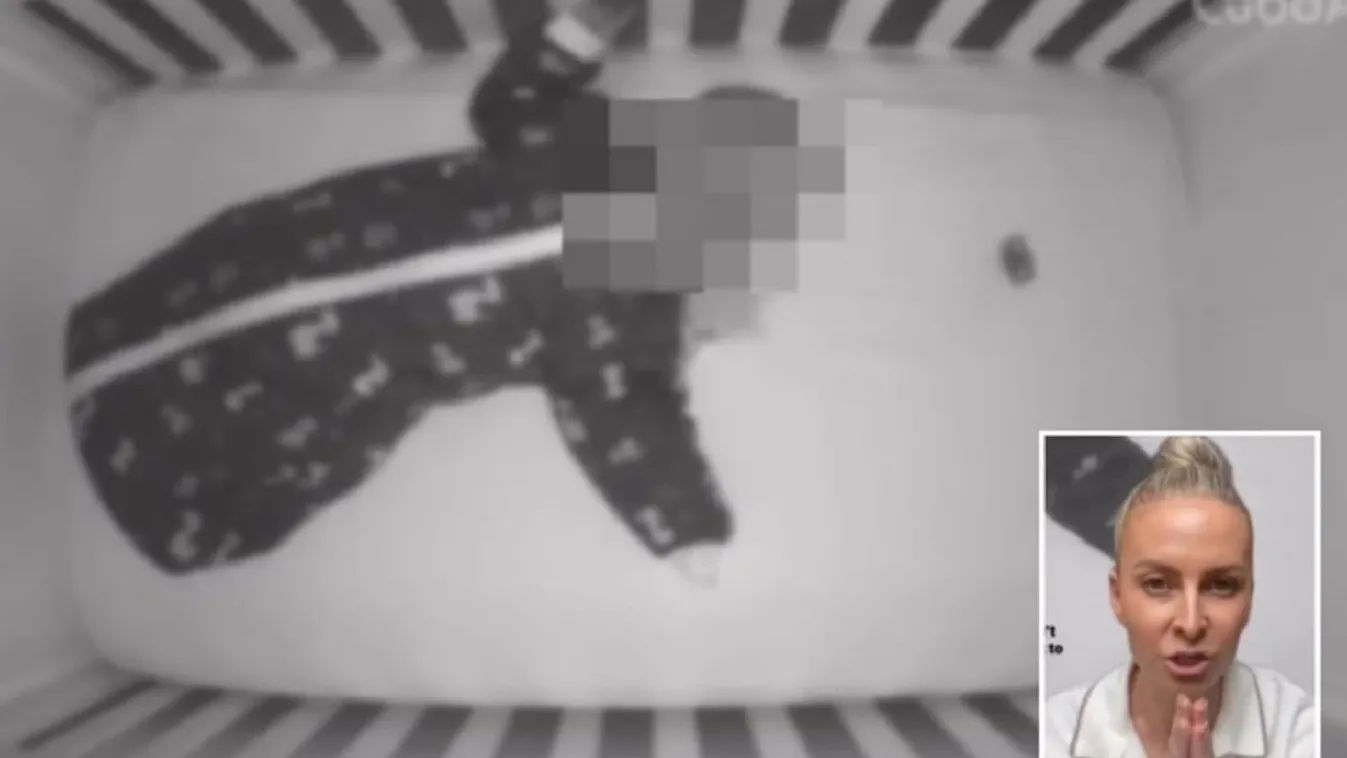 Saját cumija akadt a 7 hónapos tündéri baba torkán