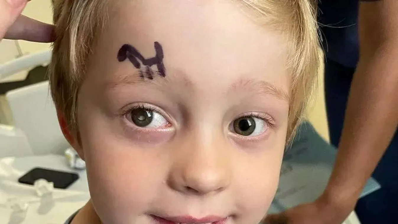 Azt hitte, csak csillog a kisfia szeme: megrázó diagnózist közöltek az orvosok