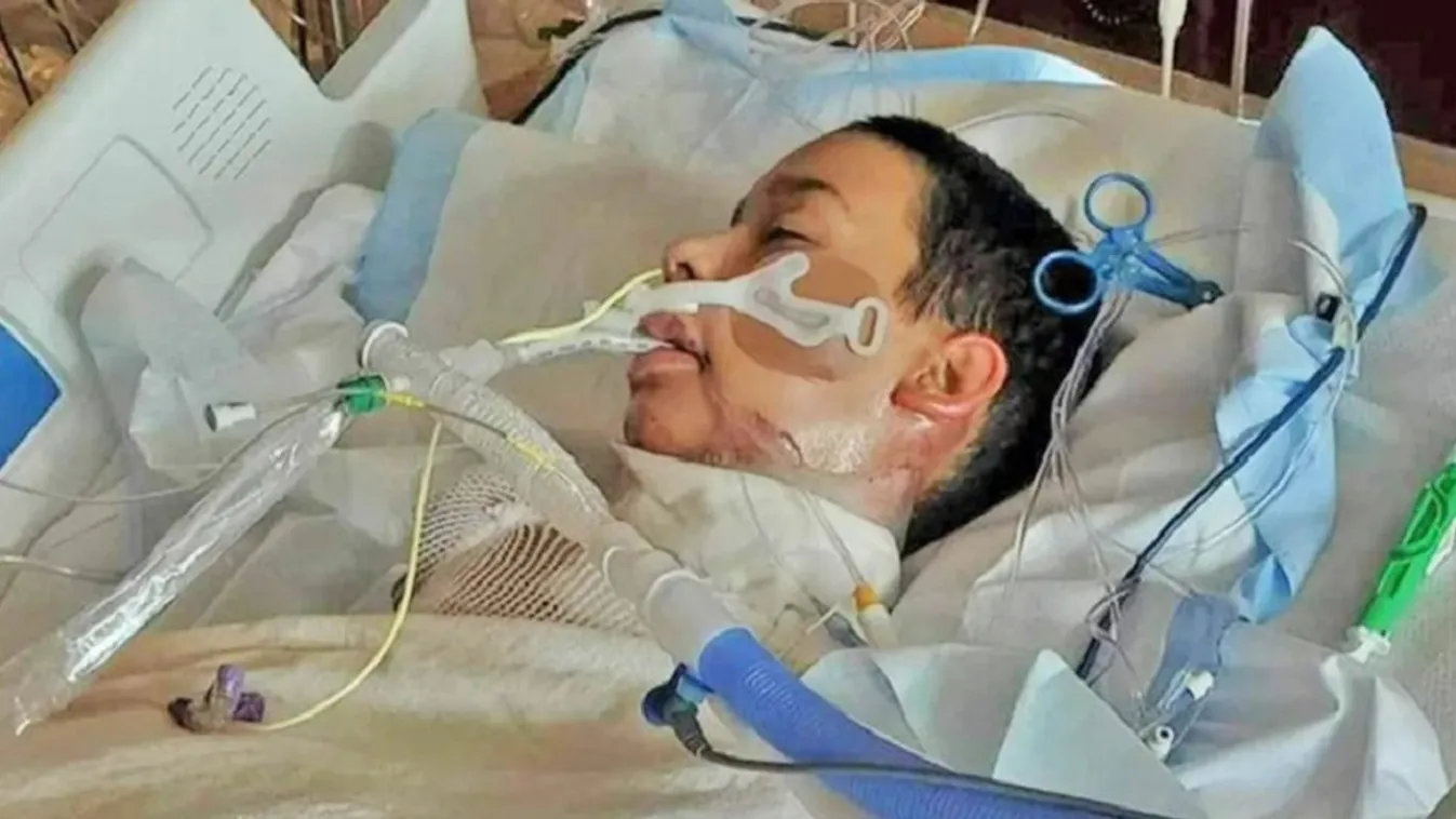 Felgyulladt egy 12 éves a Tiktok kihívás miatt