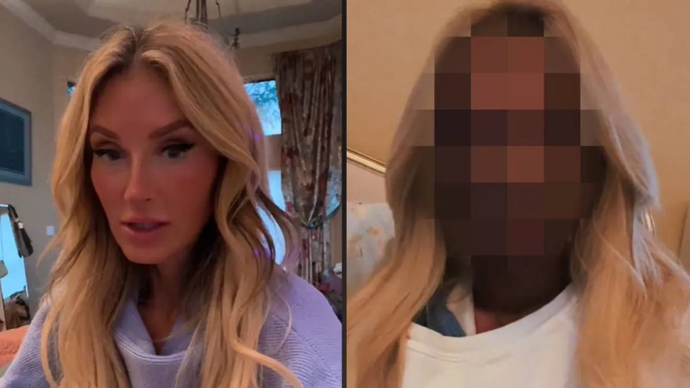 Fogorvos tette tönkre a gyönyörű anyuka arcát