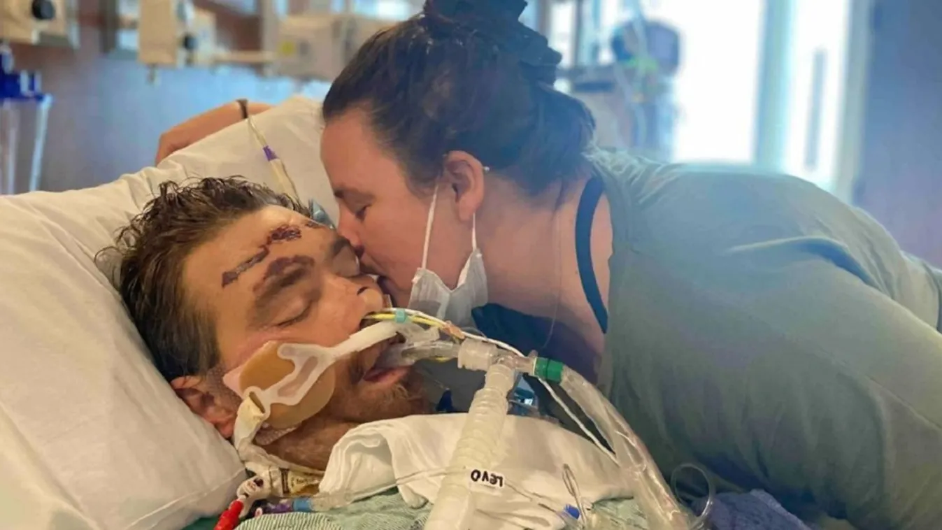 Ki akarta húzni a benőtt szőrét, agyhalott lett az apuka