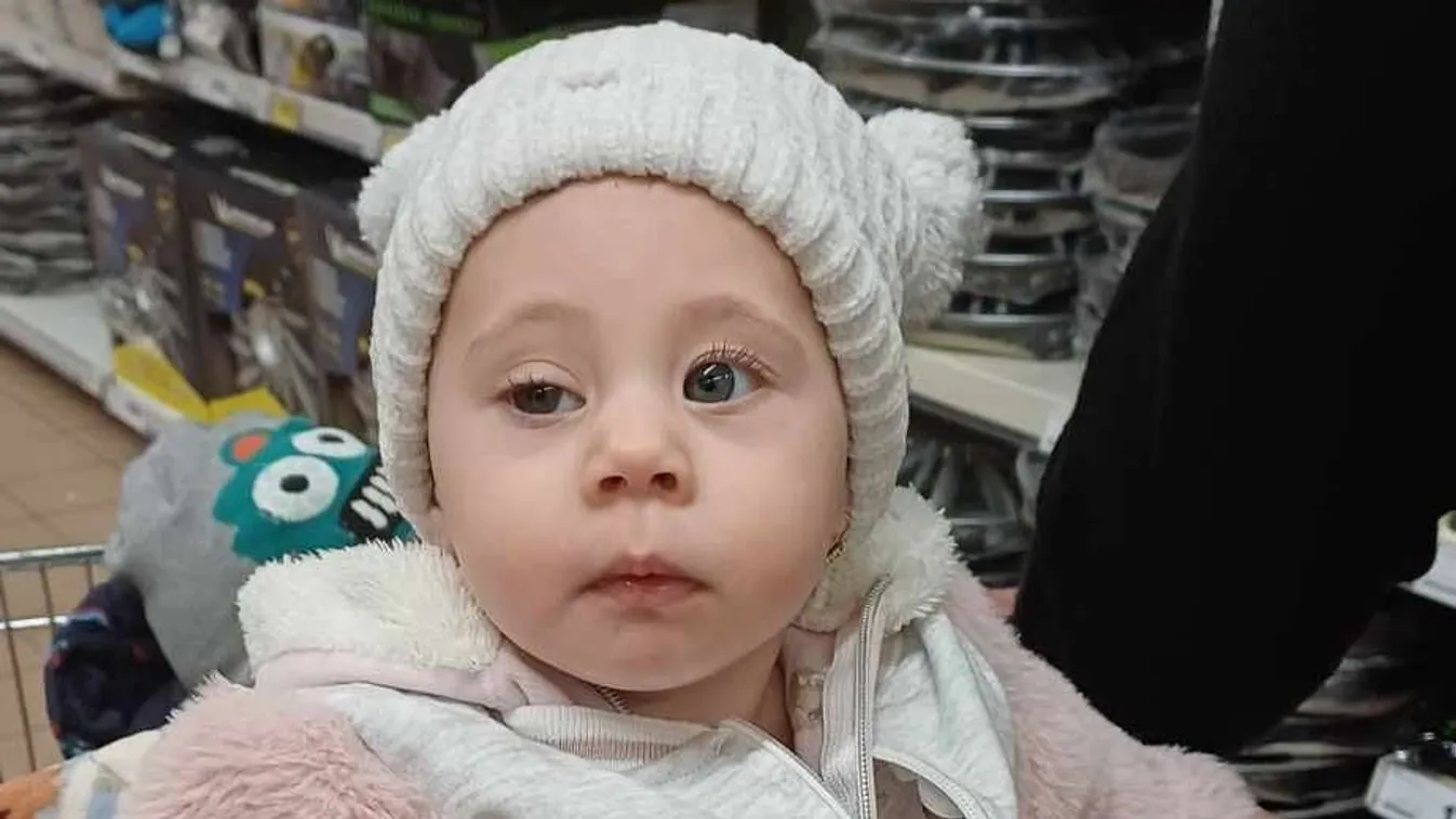 Megvakulhat az egyéves Zoé, ha nem műtik meg időben