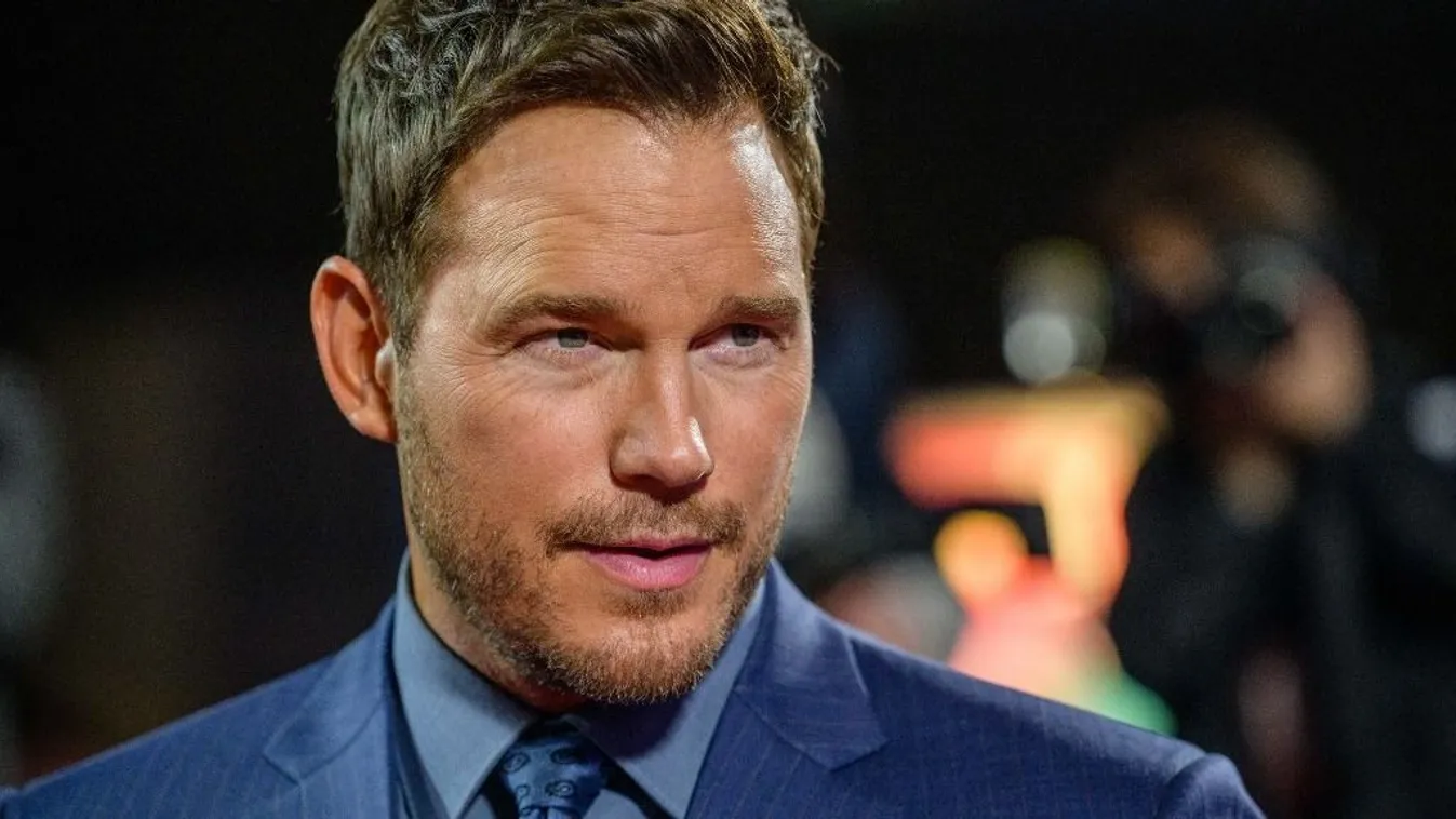 Durva balesetet szenvedett a forgatáson a Marvel sztárja